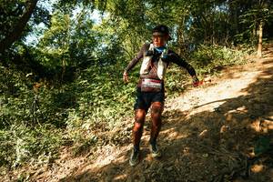 BIB: 
                            <button type="button" onclick="openModal(28152882)" class="btn btn-primary btn-sm float-right btn-popup" data-toggle="modal" data-target=".modal-high-quality">
                        <i class="fas fa-shopping-cart"></i> Add to Cart
                    </button>
                                            <button type="button" onclick="isThisMe(28152882, true)" class="btn btn-success btn-sm float-right btn-popup btn-isme hidden" data-toggle="tooltip" data-placement="bottom" title="นี่คือรูปของคุณใช่ไหม คลิกที่นี่เพื่อเอาเข้าอัลบั้ม">
                        <i class="fas fa-plus"></i> Add to album
                    </button>
                    <button type="button" onclick="isThisMe(28152882, false)" class="btn btn-warning btn-sm float-right btn-popup btn-isnotme hidden">
                        <i class="fas fa-ban"></i> Remove from album
                    </button>